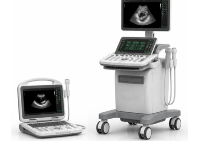 Portable Ultrasound System