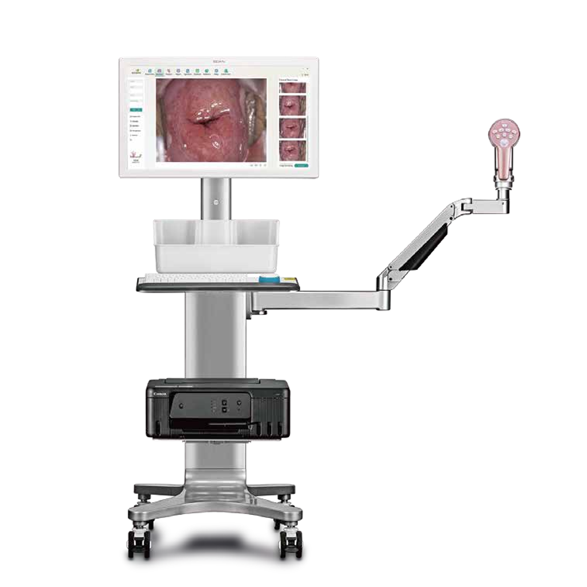 C9 UHC Video Colposcope
