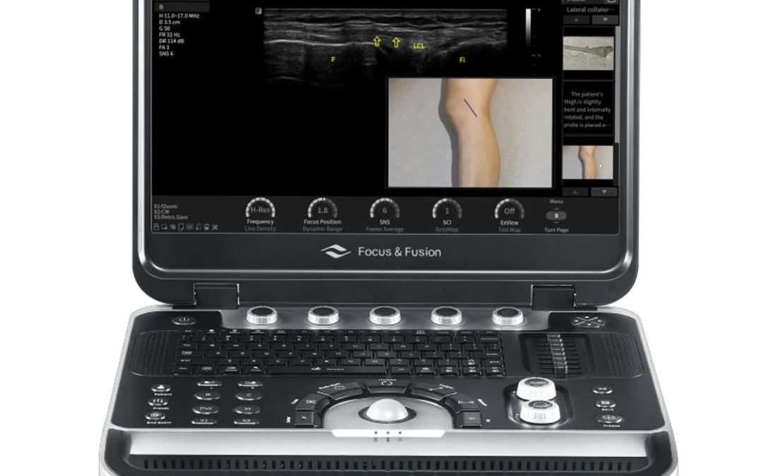 Finus 45 Infinity Ultrasound Diagnostic System