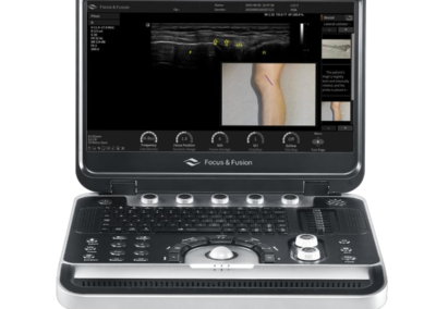 Finus 45 Infinity Ultrasound Diagnostic System