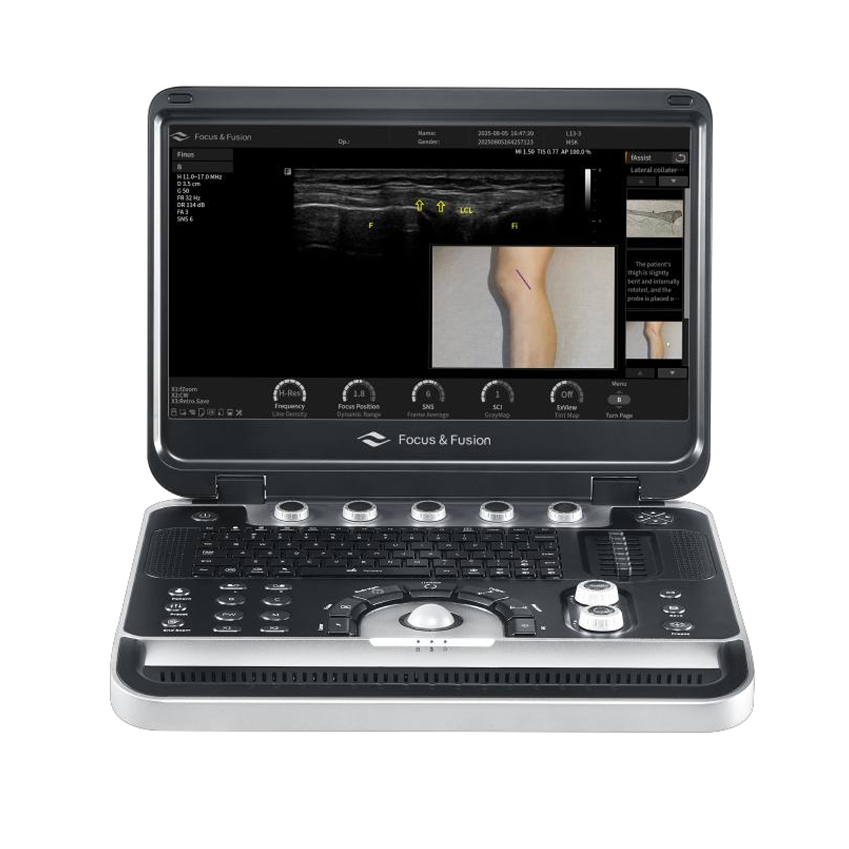 Finus 45 Infinity Ultrasound Diagnostic System