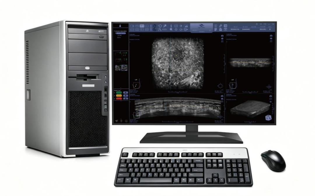 Workstation – Cygnus Series Automated Breast Ultrasound System