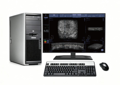 Workstation – Cygnus Series Automated Breast Ultrasound System