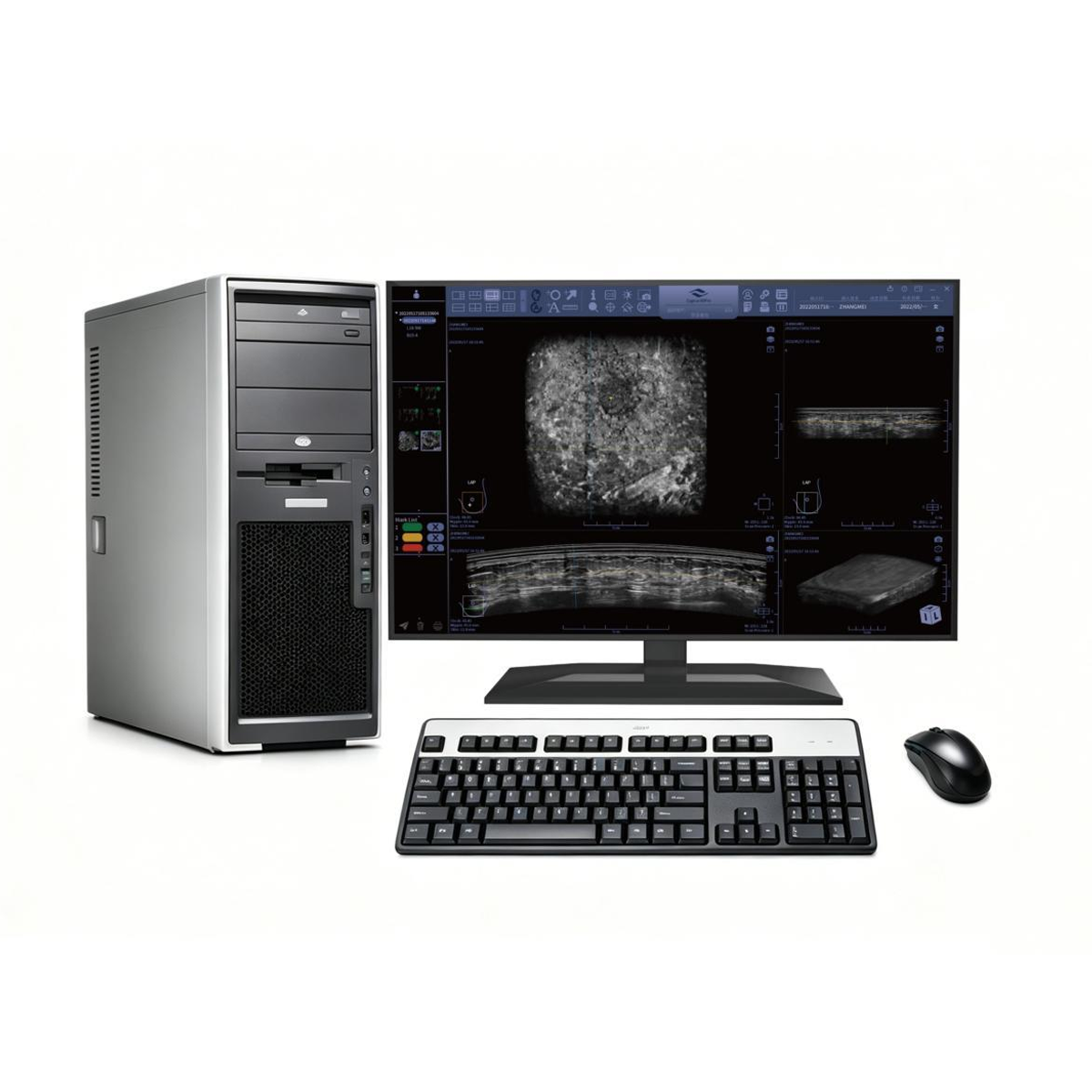 Workstation – Cygnus Series Automated Breast Ultrasound System